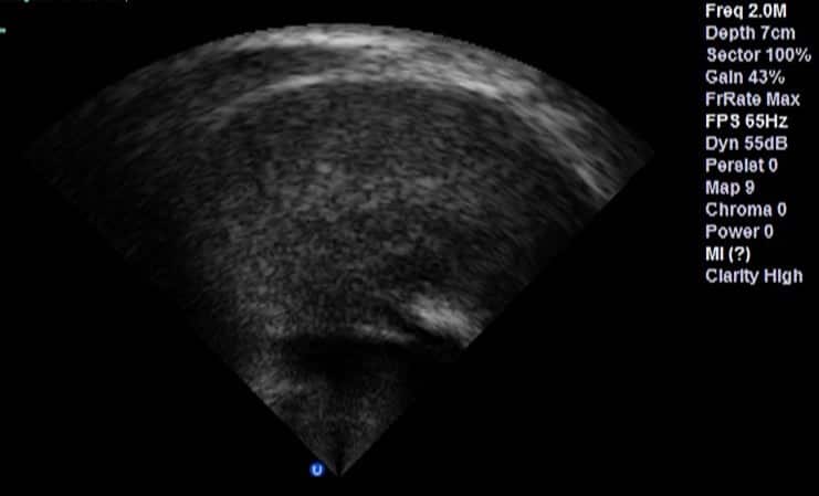 17-43-28_thin carbonated